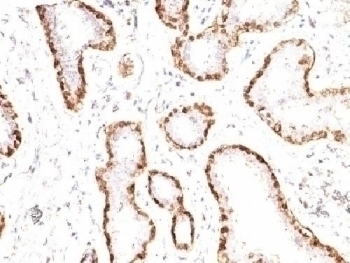 Calponin Antibody [CNN1/832]
