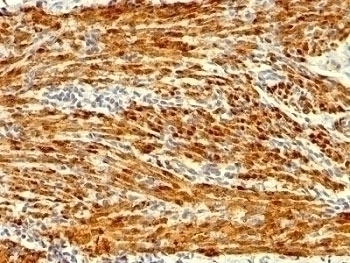 Calponin Antibody [SPM169]