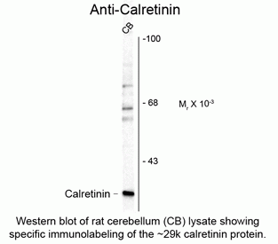 Calretinin Antibody