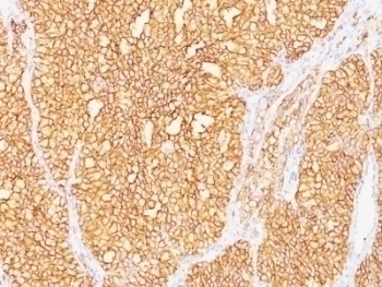 Carbonic Anhydrase IX Antibody [SPM487]
