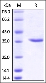 Carbonic Anhydrase IX Recombinant Protein