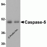 Western blot analysis of Caspase-5 in (A) human spleen tissue and (B) human thymus lysate with Caspase-5 antibody at 1 μg/mL.