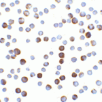<strong>Figure 6 Immunocytochemistry Validation of Caspase 9 in HeLa Cells</strong><br>Immunocytochemical analysis of HeLa cells using anti-Caspase 9 antibody (2073) at 5 μg/ml. Cells was fixed with formaldehyde and blocked with 10% serum for 1 h at RT; antigen retrieval was by heat mediation with a citrate buffer (pH6). Samples were incubated with primary antibody overnight at 4°C. A goat anti-rabbit IgG H&L (HRP) at 1/250 was used as secondary. Counter stained with Hematoxylin.
