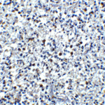 Immunohistochemistry of Cathelicidin in human spleen tissue with Cathelicidin antibody at 5 μg/ml.