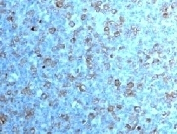 Cdc2 Antibody [CDK1/873]