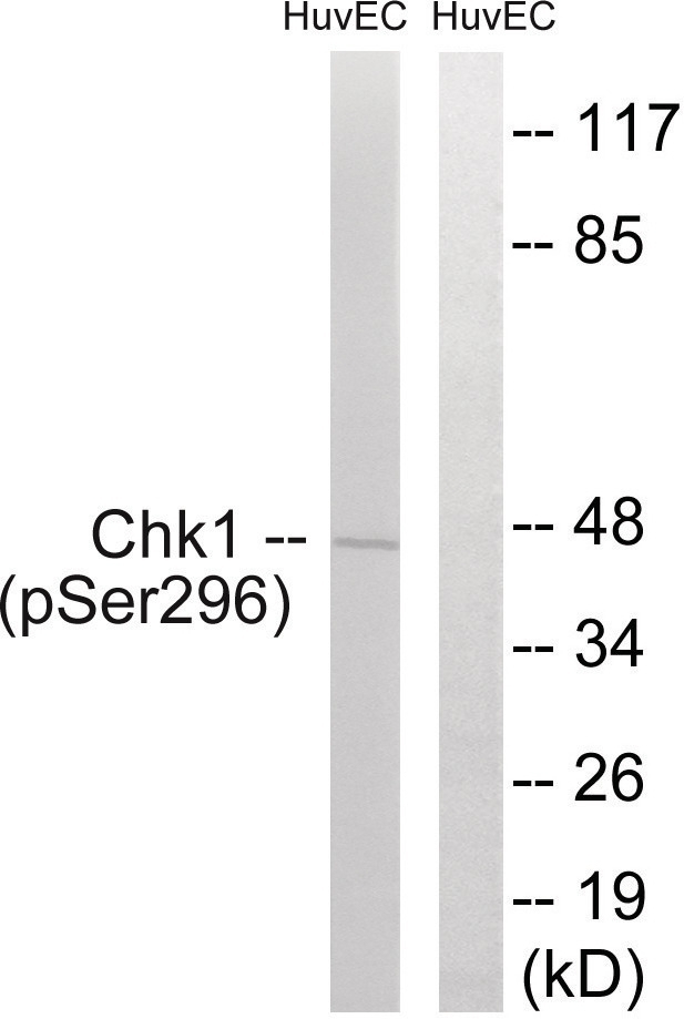 Chk1 (phospho Ser296) Antibody