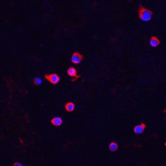 Immunofluorescence of Chk2 in Jurkat cells with Chk2 antibody at 5 μg/mL<br><br>Red: Chk2 Antibody (2391) <br> Blue: DAPI staining