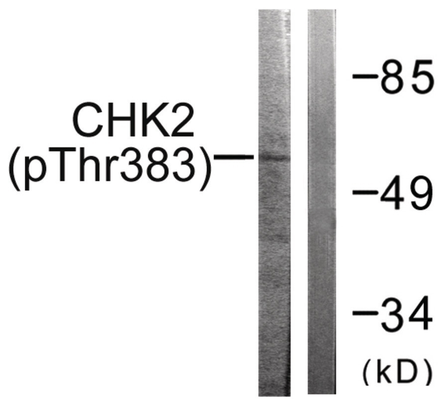 Chk2 (phospho Thr383) Antibody