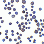 Immunocytochemistry of Chondroadherin in 3T3 cells with Chondroadherin antibody at 5 μg/ml.