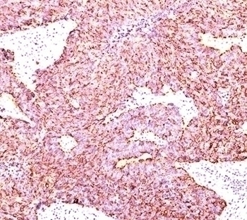 Chromogranin A Antibody [PHE5]