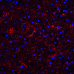 Immunofluorescence of Clusterin in human brain tissue with Clusterin antibody at 20 μg/ml.<br><br>Red: Clusterin Antibody (3856) <br> Blue: DAPI staining