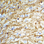 Immunohistochemistry of Clusterin in mouse brain tissue with Clusterin Antibody at 5 μg/mL.