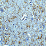 Immunohistochemistry of Clusterin in human brain tissue with Clusterin antibody at 5 μg/mL.