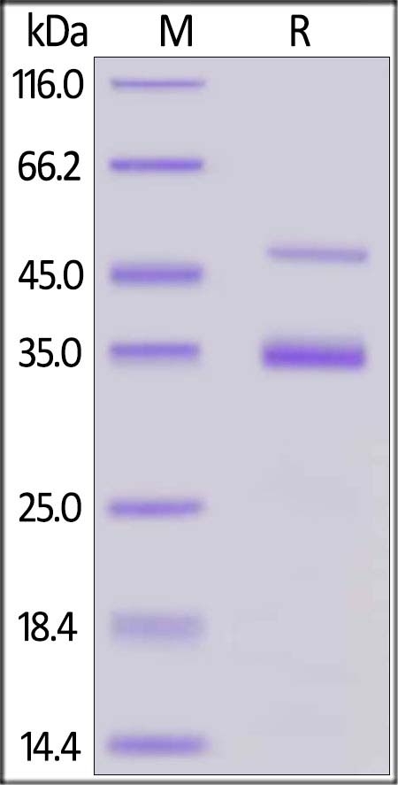 Coagulation factor XI / FXI Recombinant Protein