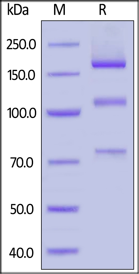Complement C5 Recombinant Protein