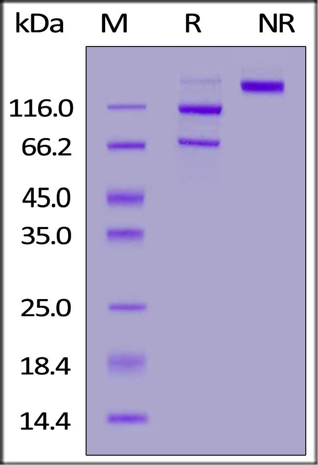 Complement C5 Recombinant Protein