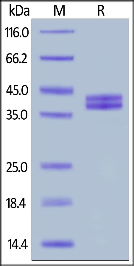 Complement Component C5a Recombinant Protein