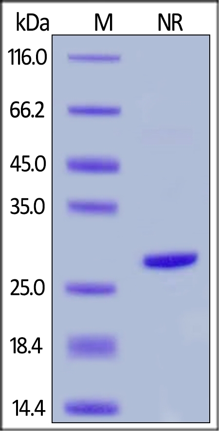 Complement Factor D / CFD Recombinant Protein