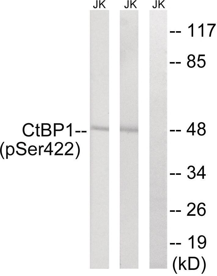 CtBP1 (phospho Ser422) Antibody