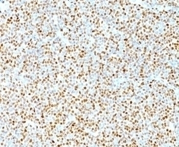 Cyclin D1 Antibody [DCS-6]