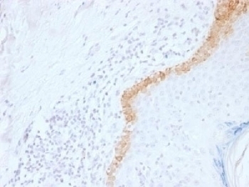Cytokeratin 15 Antibody [LHK15]