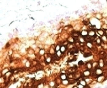 Cytokeratin 17 Antibody [SPM560]