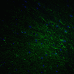 Immunofluorescence of DCLK1 in mouse brain tissue with DCLK1 Antibody at 20 μg/mL.<br><br>Green: DCLK1 Antibody (5633) <br> Blue: DAPI staining