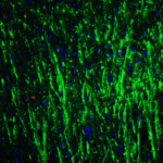 Immunofluorescence of DCLK3 in mouse brain tissue with DCLK3 Antibody at 20 μg/mL. <br><br>Green: DCLK3 antibody (5637) <br> Red: Phylloidin staining<br> Blue: DAPI staining