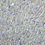 Immunohistochemistry of DCLK3 in mouse brain tissue with DCLK3 Antibody at 5 μg/mL.