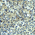 Immunohistochemistry of DEPDC1B in human spleen tissue with DEPDC1B antibody at 5 μg/ml.