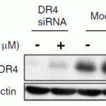<strong>Figure 7 KD Validation in SW480 cells (Goda et al., 2008) </strong><br>The expression of DR4 was knocked down via DR4 siRNA, 24 h latercells were treated with dipyridamole for 24 h. DR4 protein expression detected by anti-DR4 antibodies (1139) was disrupted. Dipyridamole up-regulated the expression of DR4.