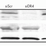 <strong>Figure 10 KD Validation in Huh7 cells (Malhi et al., 2007) </strong><br>Western blot analysis with anti-DR4 antibodies (1139) was performed for DR5 and DR4 expression using whole cell lysates from Huh 7 cells transfected with respective siRNAs. In cells treated with siDR4, a decrease in DR4 level was observed, DR5 levels were unchanged. Scrambled siRNA was used as control.
