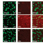 <strong>Figure 8 Immunofluorescence Validation of DR4 in rat brain (Cantarella et al., 2014) </strong><br>DR4 protein expression detected by anti-DR4 antibodies (1139) was increased after transient brain ischemia (tMCAO) and decreased after pre-conditioning stimulus. Confocal microscopic images displaying NeuN (a,d, g) (green), DR4 (b, e, h) (red), and Merge (c, f, i) (yellow) in the brain peri-ischemic region of rats after 5 h.