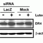 <strong>Figure 10 KD Validation in HeLa Cells (Horinaka et al., 2005) </strong><br>HeLa cells were transfected with DR4siRNA or LacZ control siRNA. At 24 h after transfection, the cells were treated with or without 20 μM luteolin for 24 h. Western blot analysis was carried out with anti-DR4 antibodies. DR4 expression was markedly reduced after DR4 knockdown.
