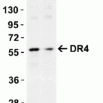 <strong>Figure 1 KO Validation in HeLa Cells</strong><br> Loading: 10 μg of HeLa WT cell lysates or DR4 KO cell lysates. Antibodies:  DR4 1167 (1 μg/mL) and beta-actin 3779 (1 μg/mL), 1 h incubation at RT in 5% NFDM/TBST.Secondary: Goat Anti-Rabbit IgG HRP conjugate at 1:10000 dilution.