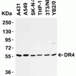 <strong>Figure 3 Western Blot Validation in Cell Lines</strong><br>Loading: 15 μg of cell lysates per lane.Antibodies: DR4 1139 (1 μg/mL), 1h incubation at RT in 5% NFDM/TBST.Secondary: Goat anti-rabbit IgG HRP conjugate at 1:10000 dilution.