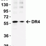 <strong>Figure 1 KO Validation in HeLa Cells</strong><br> Loading: 10 μg of HeLa WT cell lysates or DR4 KO cell lysates. Antibodies:  DR4 1139 (1 μg/mL) and beta-actin 3779 (1 μg/mL), 1 h incubation at RT in 5% NFDM/TBST.Secondary: Goat Anti-Rabbit IgG HRP conjugate at 1:10000 dilution.