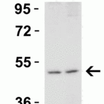<strong>Figure 4 Western Blot Validation in Mouse Cell Lines</strong><br>Loading: 15 μg of lysates per lane.Antibodies: DR5 2019, (1 μg/mL), 1h incubation at RT in 5% NFDM/TBST.Secondary: Goat anti-rabbit IgG HRP conjugate at 1:10000 dilution.