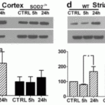 <strong>Figure 6 Regulated Expression Validation of DRAM in Heterozygous SOD2 KO Mice (Mehta et al., 2011) </strong><br>DRAM expression level detected by anti-DRAM antibodies (4033) decreased in striatum of SOD <sup>-/+ </sup> KO mice (fig. d) as compared to WT mice .