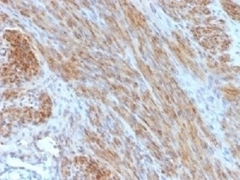 Desmin Antibody [DES/1711]
