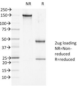 Desmoglein 1 Antibody [27B2]