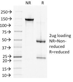 Desmoglein 2 Antibody [6D8]