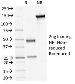 Desmoglein 3 Antibody [5H10]