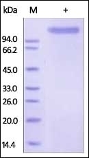 E-Selectin Recombinant Protein
