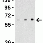 <strong>Figure 2 Recombinant Protein Validation </strong><br>Loading: 30 ng of human recombinant IL-17 (IL-17A+IL-17B) protein per lane.Antibodies: EBI-3 4967, 1h incubation at RT in 5% NFDM/TBST.Secondary: Goat anti-rabbit IgG HRP conjugate at 1:10000 dilution.Lane 1: 1 μg/mL, Lane 2: 2 μg/mL, Lane 3: 4 μg/mL,