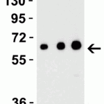 <strong>Figure 2 Recombinant Protein Validation </strong><br>Loading: 30 ng of human recombinant IL-17 (IL-17A+IL-17B) protein per lane.Antibodies: EBI-3 4977, 1h incubation at RT in 5% NFDM/TBST.Secondary: Goat anti-rabbit IgG HRP conjugate at 1:10000 dilution.Lane 1: 0.5 μg/mL, Lane 2: 1 μg/mL, Lane 3: 2 μg/mL,