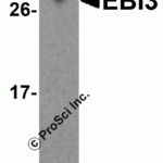 <strong>Figure 1 Western Blot Validation in Human Tonsil Tissue</strong><br>Loading: 15 μg of lysates per lane.Antibodies: EBI-3 4967 (2 μg/mL), 1h incubation at RT in 5% NFDM/TBST.Secondary: Goat anti-rabbit IgG HRP conjugate at 1:10000 dilution.