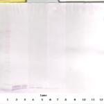 To detect hEGF by Western Blot analysis this antibody can be used at a concentration of 0.1-0.2 ug/ml. Used in conjunction with compatible secondary reagents the detection limit for recombinant hEGF is 1.5-3.0 ng/lane, under either reducing or non-reducing conditions.