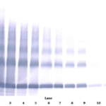 To detect hEMAP-II by Western Blot analysis this antibody can be used at a concentration of 0.1 - 0.2 ug/ml. Used in conjunction with compatible secondary reagents the detection limit for recombinant hEMAP-II is 1.5 - 3.0 ng/lane, under either reducing or non-reducing conditions.