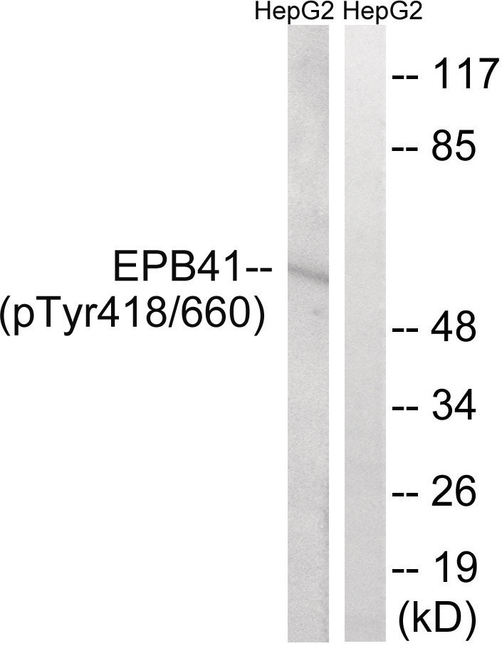EPB41 (phospho Tyr660/418) Antibody